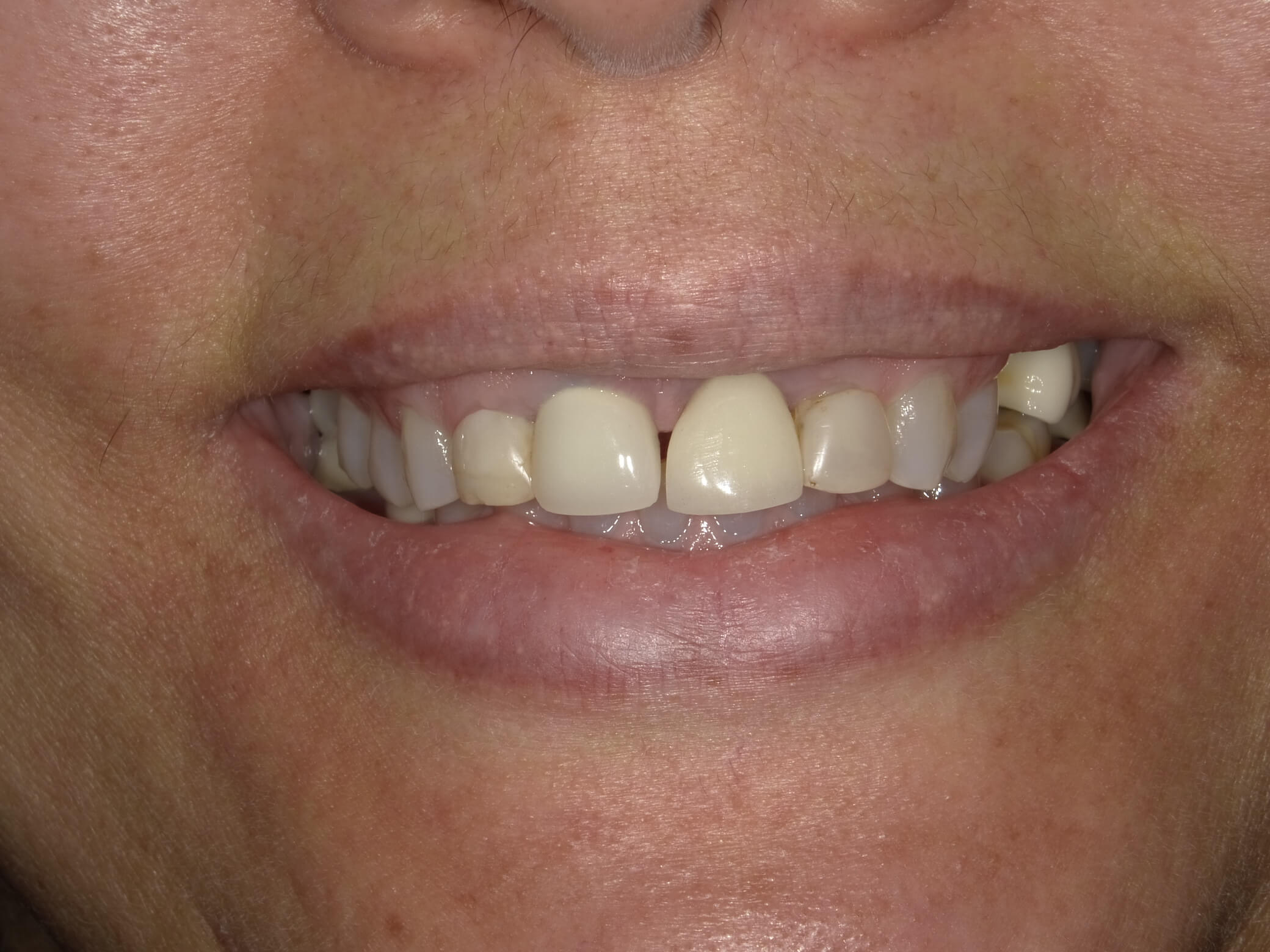 Case 2 – cosmetics